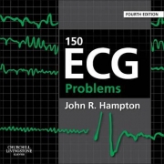 150 ECG Problems 4th Ed.